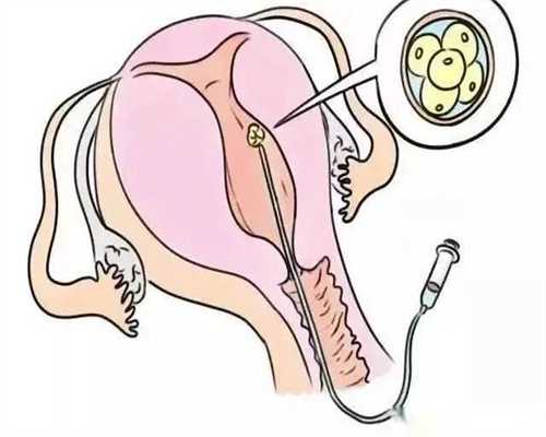 添喜宝助孕[aa69助孕网靠谱吗]+试管婴儿前要检查激素吗 北京不孕不育医院排行