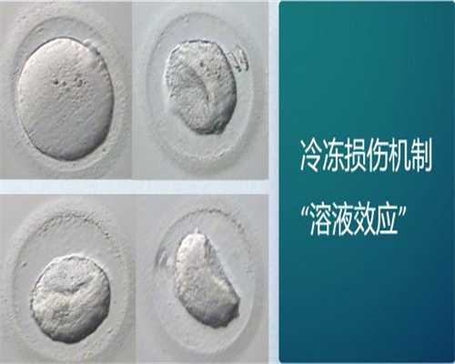 杭州试管代生机构_四平试管婴儿医生推荐-2026四平口碑好的试管医生排名