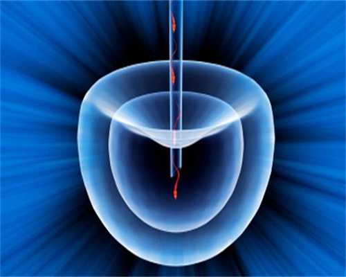 无锡权威代怀孕|一直生女孩是不是老公y精子缺失的原因?_9QH20