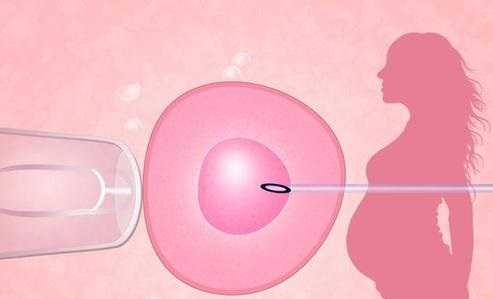 试管婴儿拮抗剂方案的优缺点